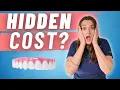 How Much Should Dental Implants Really Cost