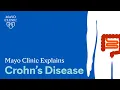 Mayo Clinic Explains Crohn s Disease