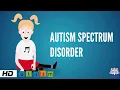 Autism Spectrum Disorder Causes Signs and Symptoms Diagnosis and Treatment