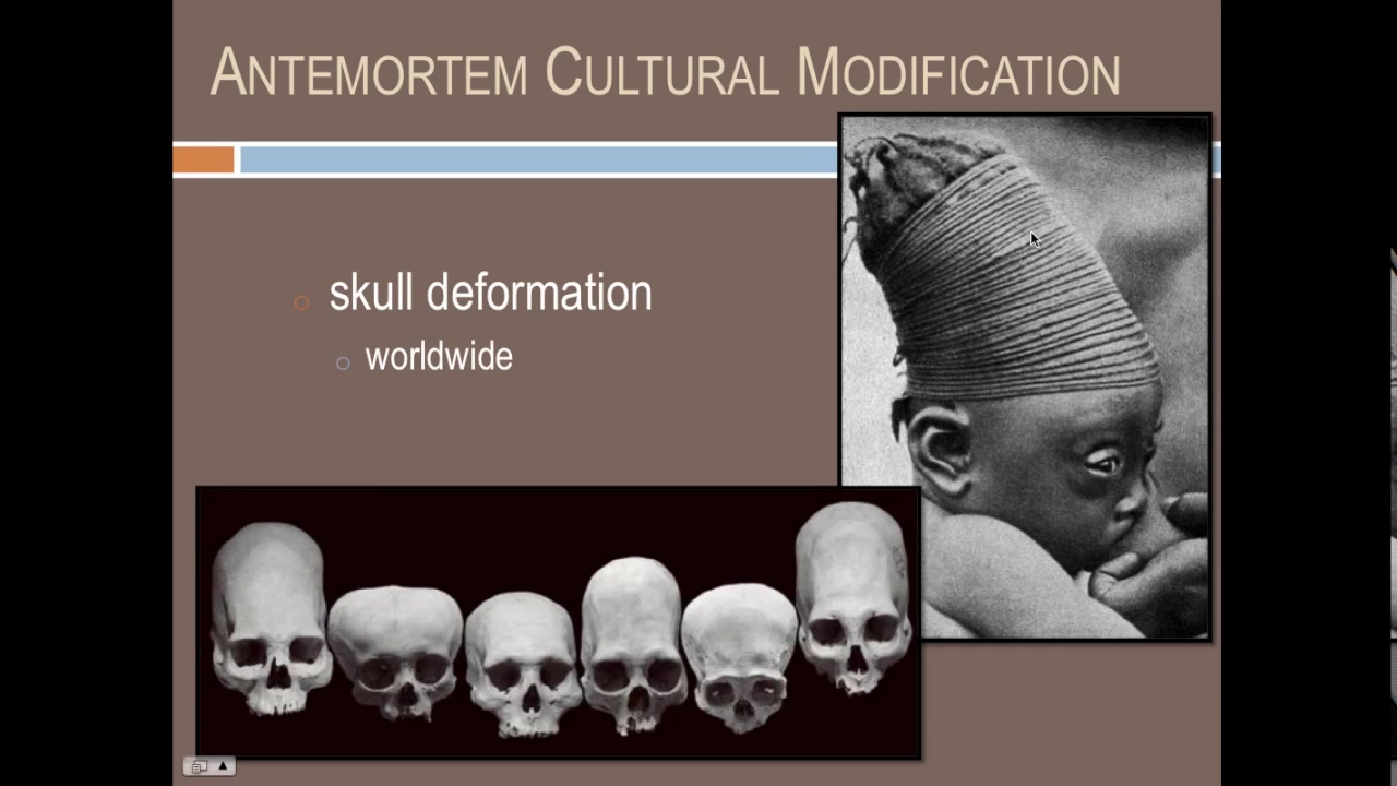 Forensic Anthropology: Assessing Damage