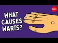 What are warts and how do you get rid of them - Cella Wright