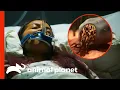 Download Lagu Tick Bite Infects Woman With Rare Parasites | Monsters Inside Me