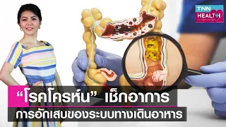 แพทย์วินิจฉัยโรคโคลนอย่างไร