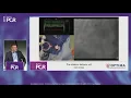 Download Lagu SYNTAX II Trial: Complex PCI Case in a High-Risk Patient
