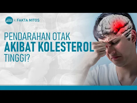 Benarkah Kolesterol Tinggi Bisa Mengakibatkan Pendarahan Otak?