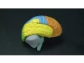 Brain Dissection