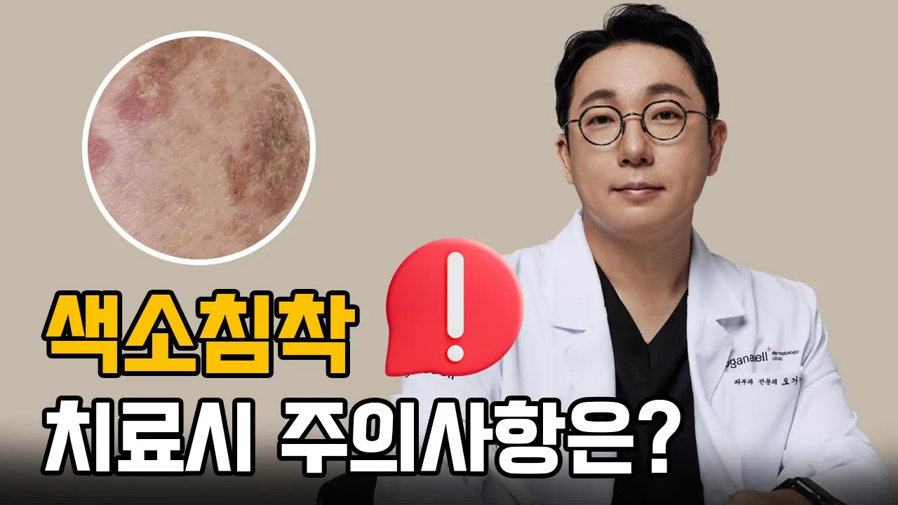 색소침착치료 주의사항은? │색소침착