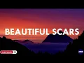 Beautiful Scars - Moira Dela Torre and Maximillian (Lyrics) [acoustic] | Your Music Corner