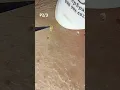 Blackhead