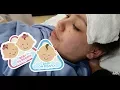 Download Lagu NATURAL BIRTH OF TRIPLETS (ENGLISH SUBS)