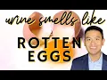 5 Reasons Why Your Urine Smells Like Rotten Eggs or Sulfur