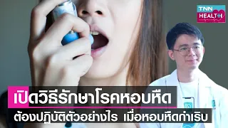 โรคหอบหืดมีกี่ระดับความรุนแรง และแต่ละระดับหมายถึงอะไรบ้าง