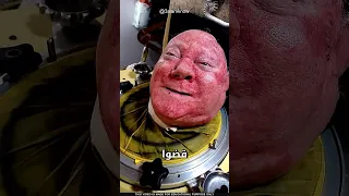 ما سر الرئة الحديدية 