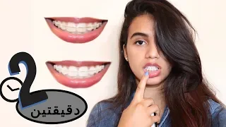 تبييض الأسنان في دقيقتين فقط بياض مضمون Giveaway  تبييض الأسنان في دقيقتين فقط بياض مضمون Giveaway