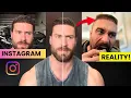 2 Years after CBUM s Hair Transplant Now What