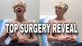 ftm top surgery reveal vlog part 2 noahfinnce