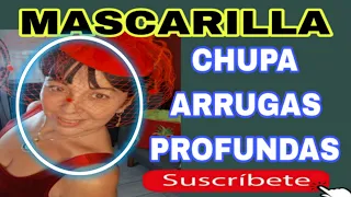 ELIMINA ARRUGAS PROFUNDAS #ARRUGAS