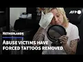 More than skin deep Dutch abuse victims erase forced tattoos AFP