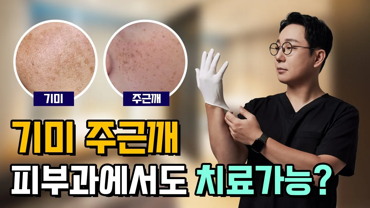 진한 기미랑 주근깨도 제거할 수 있나요? │기미 주근깨