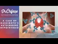 MASTERCLASS HASHIMOTO S THYROID CASE STUDY