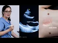 Probe Positioning For Scanning Patients Flat