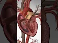 Download Lagu What happens during a Cardiac Arrest of the Heart #cardiacarrest #heartattack #heartdisease
