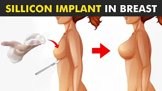 Breast Augmentation Breast Surgery To Increase Breast Size 