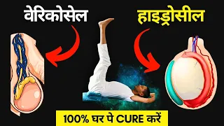 varicocele u0026 hydrocele yoga for varicocele u0026 hydrocele hindi menshealth