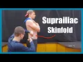 Suprailliac Skinfold