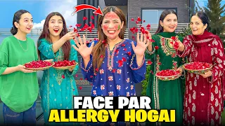 Face Par Severe Allergy Hogai😱💔|Lahore’s Cheapest Bazaar🤩🛍️|Accident Prank Kadia😰🚗|Fatima Faisal