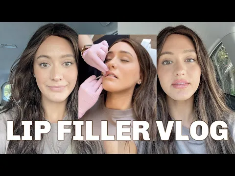 Download MP3 LIP FILLER VLOG | Before and after + the healing process!