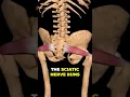 What s Really Causing Your Butt and Leg Pain The Shocking Truth
