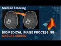 Median Filter MATLAB Code Implementation Medical Image Processing Computer Vision