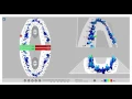 T-Scan Novus Introduction