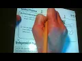16 1 Classifying Triangles