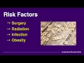 Sneak Peak 2 - Stats and Risk Factors