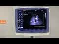 Download Lagu Demo Emperor EMP 3000 highly professional color doppler Best price in Pakistan Call 03214447817