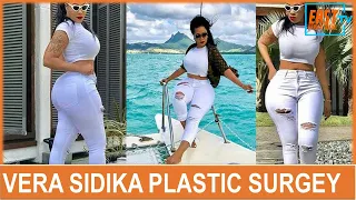 vera sidika does plastic surgery again 