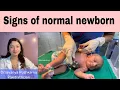 Newborn - normal vitals heart rate breathing temperature the baby doctor