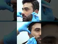 Laser Beard Shaping for Sharp Looks | The Aesthetics Clinic #beardgrooming #menstyle