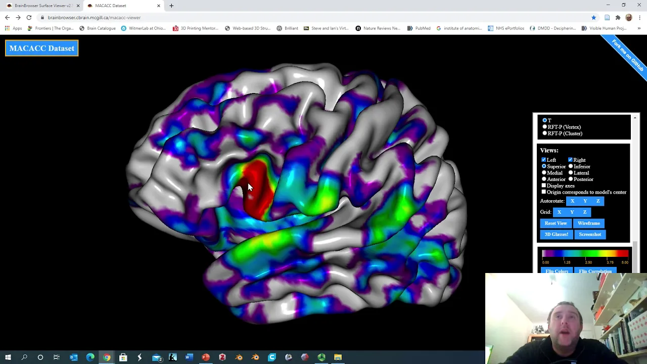 Functional MRI and diffusion imaging