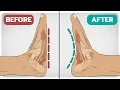 5 Exercises To Fix Flat-Feet Fallen Arches