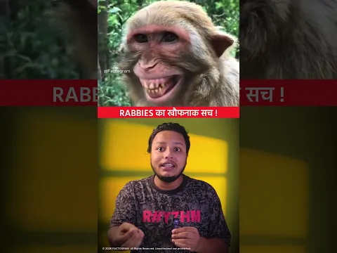RABBIES का खौफनाक सच ! 😳😳 Why Is Rabies So Deadly? #shorts #dailyfacts