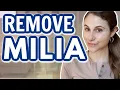 TOP 5 products for MILIA REMOVAL Dr Dray