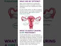 What Kind of Fibroids Do You Have Dr Shiloh Explains How to Decode Your Ultrasound