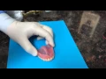Thinnest Unbreakable TCS Flexi Full Denture