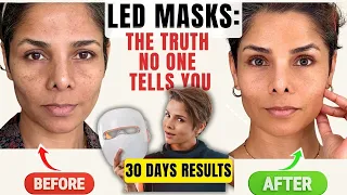 No One Tells You This About LED Masks (Ulike ReGlow 1 Month Before & After)