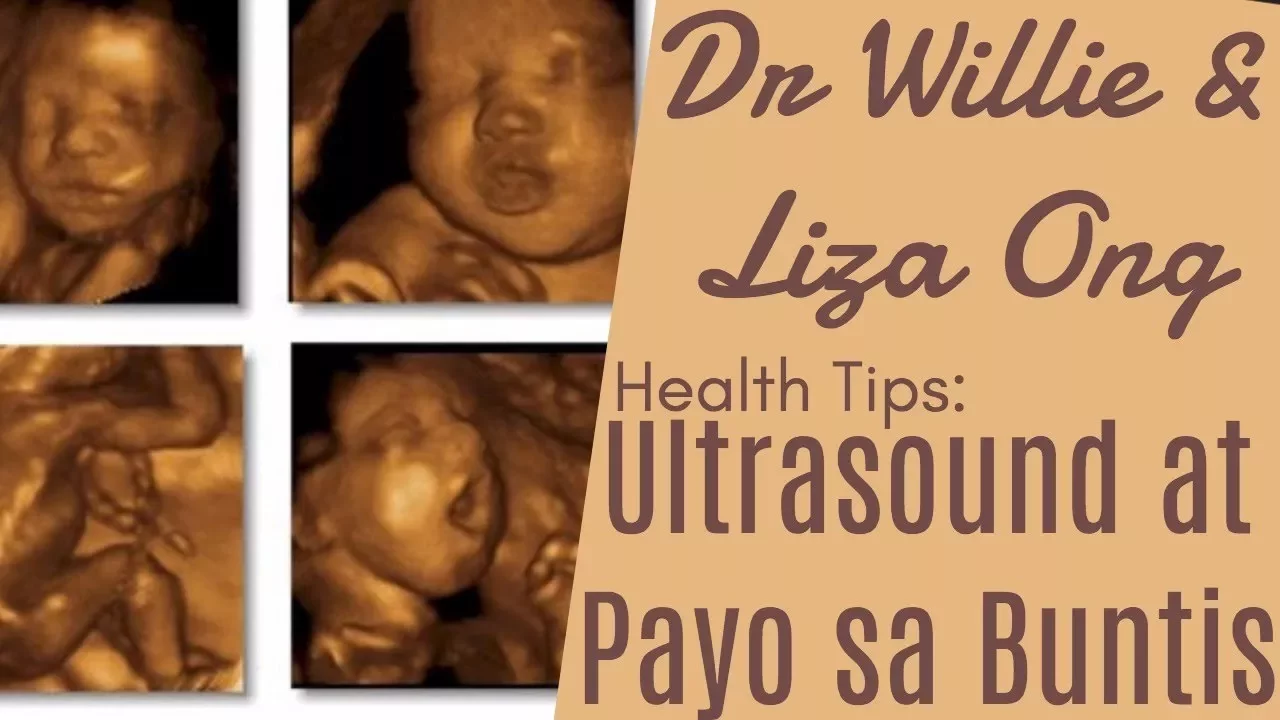 Ultrasound sa Buntis at Payo sa Buntis - ni Doc Sharon Mendoza #4