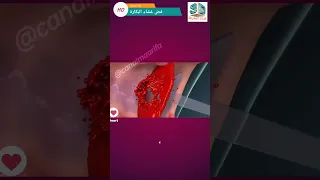 كيف يفض غشاء البكارة Biology المرأة الزواج  كيف يفض غشاء البكارة Biology المرأة الزواج
