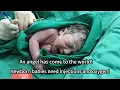Download Lagu #newborns #baby #pregnant women giving birth#multiple births#twin#新生儿